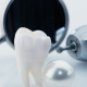 The Future of Dental Restorations: A Closer Look at Zirconia Crowns